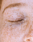 Siero Viso Antimacchie e Discromie all'Acido Cogico