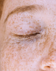 Crema viso anti-macchie con acido cogico